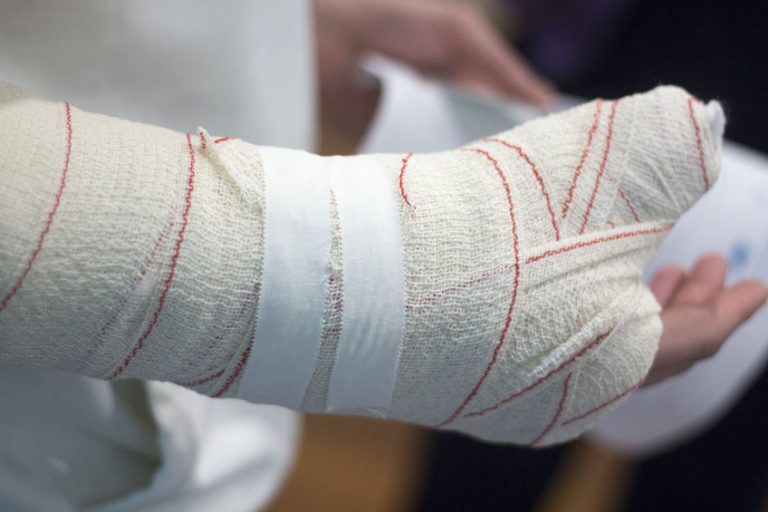 Broken Hand Compensation Claims In The UK