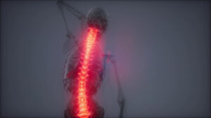 A X-Ray of a person from behind with the spine highlighted in red. 